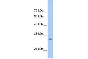 WB Suggested Anti-NSBP1 Antibody Titration:  0. (HMGN5 Antikörper  (Middle Region))