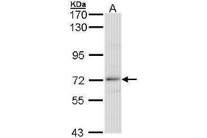 WB Image Sample (30 ug of whole cell lysate) A: 293T 7. (BTRC Antikörper)