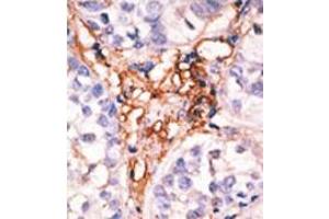 Image no. 2 for anti-Apolipoprotein B mRNA Editing Enzyme, Catalytic Polypeptide-Like 3G (APOBEC3G) (Middle Region) antibody (ABIN356858)