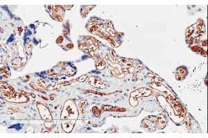 ABIN185194 (2µg/ml) staining of paraffin embedded Human Placenta. (PIK3C2A Antikörper  (C-Term))
