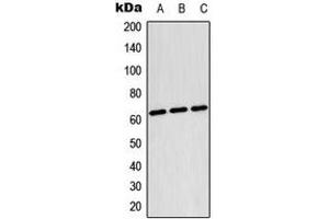Western blot analysis of TESK2 expression in Raji (A), HepG2 (B), NIH3T3 (C) whole cell lysates. (TESK2 Antikörper  (Center))