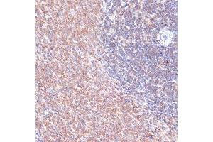 Immunohistochemistry (IHC) image for anti-Thioredoxin-Related Transmembrane Protein 1 (TMX1) (AA 210-280) antibody (ABIN7270808)