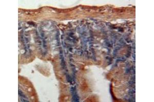 Immunohistochemistry (IHC) image for anti-Angiogenic Factor with G Patch and FHA Domains 1 (AGGF1) (AA 263-507) antibody (ABIN1857943)