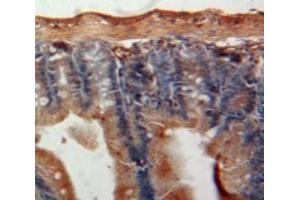 Used in DAB staining on fromalin fixed paraffin-embedded Intestine tissue (AGGF1 Antikörper  (AA 263-507))