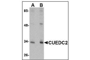 Western blot analysis of CUEDC2 in HeLa cell lysate with CUEDC2 antibody at (A) 1 and (B) 2 µg/ml (CUEDC2 Antikörper  (C-Term))