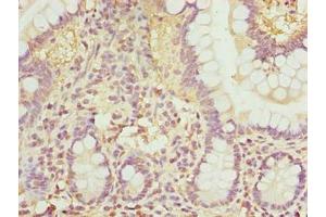 Immunohistochemistry of paraffin-embedded human small intestine tissue using ABIN7168034 at dilution of 1:100 (RhoF Antikörper  (AA 1-170))