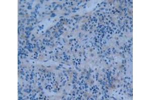 Used in DAB staining on fromalin fixed paraffin- embedded Kidney tissue (PTPRH Antikörper  (AA 551-802))