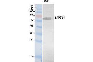 Western Blotting (WB) image for anti-Zinc Finger Protein 384 (ZNF384) (Internal Region) antibody (ABIN3178547) (ZNF384 Antikörper  (Internal Region))
