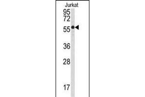 Western Blotting (WB) image for anti-Protein Phosphatase 3, Catalytic Subunit, beta Isozyme (PPP3CB) (AA 1-30), (N-Term) antibody (ABIN392893)