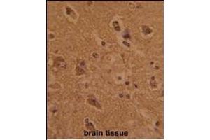 Formalin-fixed and paraffin-embedded human brain tissue with CTDP1 Antibody (N-term), which was peroxidase-conjugated to the secondary antibody, followed by DAB staining. (CTDP1 Antikörper  (N-Term))