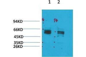 Western Blot (WB) analysis of 1) Rat Brain Tissue, 2)Mouse Brain Tissue with KV11. (KCNH2 Antikörper)