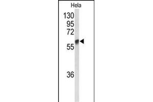 Western blot analysis of GALNT2 Antibody (N-term) (ABIN653281 and ABIN2842795) in Hela cell line lysates (35 μg/lane). (GALNT2 Antikörper  (N-Term))