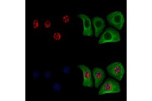 ABIN6256252 and ABIN6267454 staining Hela cells(4h of LPS treatment) by IF/ICC. (MKP1/2 (pSer296), (pSer318) Antikörper)