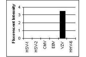 Cross Reactivity Results determined by IFA (CD236/GYPC Antikörper)