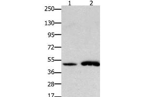 Western Blot analysis of Mouse brain and heart tissue using FOXL2 Polyclonal Antibody at dilution of 1:750 (FOXL2 Antikörper)