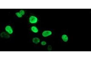 Anti-PPARA mouse monoclonal antibody (ABIN2455018) immunofluorescent staining of COS7 cells transiently transfected by pCMV6-ENTRY PPARA (RC216176). (PPARA Antikörper  (AA 145-420))