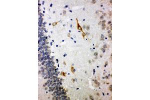 Anti-Somatostatin antibody, IHC(P) IHC(P): Rat Brain Tissue (Somatostatin Antikörper  (C-Term))