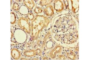 Immunohistochemistry of paraffin-embedded human kidney tissue using ABIN7173015 at dilution of 1:100 (TMPRSS7 Antikörper  (Ser7))