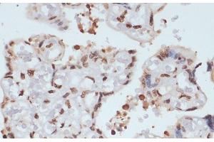 Immunohistochemistry of paraffin-embedded Human placenta using Phospho-CHEK1(S280) Polyclonal Antibody at dilution of 1:100 (40x lens). (CHEK1 Antikörper  (pSer280))