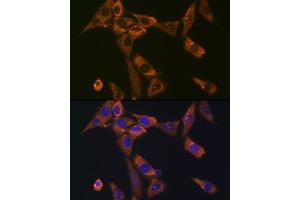 Immunofluorescence analysis of NIH-3T3 cells using Galectin 1/LG Rabbit mAb (ABIN7268197) at dilution of 1:100 (40x lens). (LGALS1/Galectin 1 Antikörper)