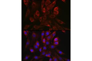 Immunofluorescence analysis of NIH/3T3 cells using TGF beta 1 antibody (ABIN7270909) at dilution of 1:150. (TGFB1 Antikörper  (AA 30-278))