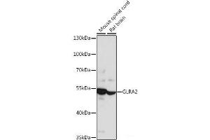 Western blot analysis of extracts of various cell lines using GLRA2 Polyclonal Antibody at dilution of 1:1000. (GLRa2 Antikörper)
