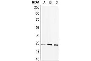 Western blot analysis of HLA-DQB2 expression in HEK293T (A), MCF7 (B), Raw264.