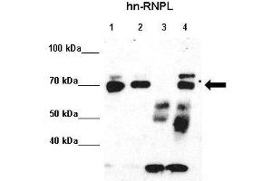 Immunoprecipitation (IP) image for anti-Heterogeneous Nuclear Ribonucleoprotein L (HNRNPL) (N-Term) antibody (ABIN2778777)