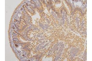 IHC analysis of RAB3GAP2 using anti-RAB3GAP2 antibody (ABIN6719633). (RAB3GAP2 Antikörper  (AA 1-115))