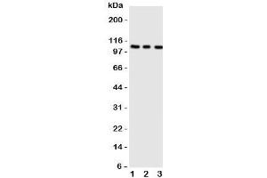 Western blot testing of ADAMTS1 antibody;  Lane 1: rat liver;  2: (r) heart;  3: (r) brain tissue lysate. (ADAMTS1 Antikörper  (AA 956-968))