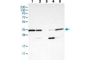 Western blot analysis of Lane 1: RT-4, Lane 2: U-251 MG, Lane 3: Human Plasma, Lane 4: Liver, Lane 5: Tonsil with C7orf20 polyclonal antibody . (Chromosome 7 Open Reading Frame 20 (C7orf20) Antikörper)