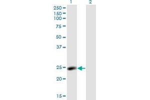 Western Blot analysis of LYPLA2 expression in transfected 293T cell line by LYPLA2 monoclonal antibody (M01), clone 3H5.