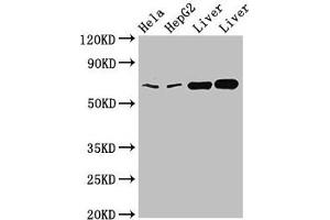 Western Blot Positive WB detected in: Hela whole cell lysate, HepG2 whole cell lysate, Rat liver tissue, Mouse liver tissue All lanes: CLINT1 antibody at 2 μg/mL Secondary Goat polyclonal to rabbit IgG at 1/50000 dilution Predicted band size: 69, 71 kDa Observed band size: 69 kDa (CLINT1 Antikörper  (AA 1-625))