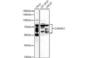 Western blot analysis of extracts of various cell lines, using C antibody (ABIN6130036, ABIN6137894, ABIN6137895 and ABIN6225248) at 1:500 dilution. (CAMKK2 Antikörper  (AA 1-140))