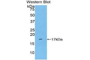 Western Blotting (WB) image for anti-Killer Cell Lectin-Like Receptor Subfamily B, Member 1 (KLRB1) (AA 73-188) antibody (ABIN1859563) (CD161 Antikörper  (AA 73-188))