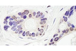 Immunohistochemistry (IHC) image for anti-Tyrosyl-DNA Phosphodiesterase 1 (TDP1) (AA 1-50) antibody (ABIN7453800)