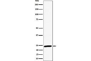 Western blot analysis of RAB8A expression in HeLa cell lysate.