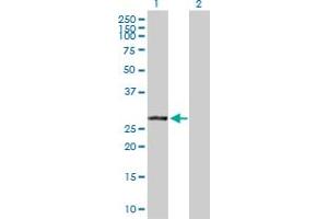 Western Blot analysis of VAPB expression in transfected 293T cell line by VAPB MaxPab polyclonal antibody. (VAPB Antikörper  (AA 1-243))