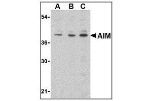 Image no. 1 for anti-CD5 Molecule-Like (CD5L) (C-Term) antibody (ABIN200118) (CD5L Antikörper  (C-Term))