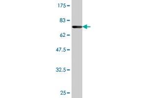 Western Blotting (WB) image for anti-Transcobalamin I (Vitamin B12 Binding Protein, R Binder Family) (TCN1) (AA 1-423) antibody (ABIN520794)