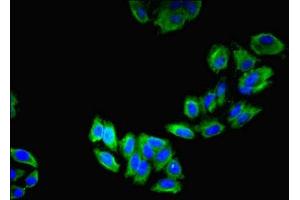 Immunofluorescent analysis of HepG2 cells using ABIN7158804 at dilution of 1:100 and Alexa Fluor 488-congugated AffiniPure Goat Anti-Rabbit IgG(H+L) (LAMP2 Antikörper  (AA 54-268))