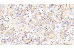 Immunohistochemistry (IHC) image for anti-Sphingosine Kinase 1 (SPHK1) (AA 148-398) antibody (ABIN7435844)