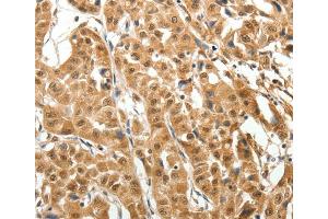 Immunohistochemistry (IHC) image for anti-Microtubule-Associated Protein 1A (MAP1A) antibody (ABIN2426949) (MAP1A Antikörper)