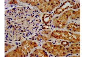 IHC image of ABIN7152853 diluted at 1:500 and staining in paraffin-embedded human kidney tissue performed on a Leica BondTM system. (FGFRL1 Antikörper  (AA 403-470))