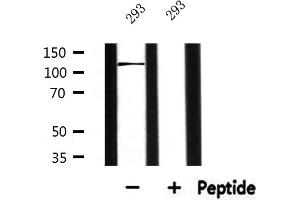 Western blot analysis of extracts from 293, using ATXN2L Antibody. (Ataxin 2-Like Antikörper  (Internal Region))