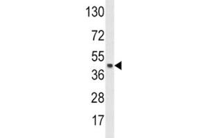 Western blot analysis of SKP2 antibody and HeLa lysate. (SKP2 Antikörper  (AA 156-185))