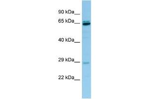 WB Suggested Anti-PRB3 Antibody Titration: 1.