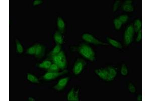 Immunofluorescent analysis of Hela cells using ABIN7148556 at dilution of 1:100 and Alexa Fluor 488-congugated AffiniPure Goat Anti-Rabbit IgG(H+L) (COBLL1 Antikörper  (AA 1-106))