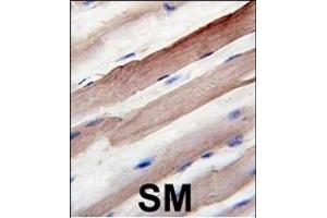 Formalin-fixed and paraffin-embedded human skeletal muscle reacted with Autophagy G4B Antibody  1809d , which was peroxidase-conjugated to the secondary antibody, followed by DAB staining. (ATG4B Antikörper  (AA 258-284))
