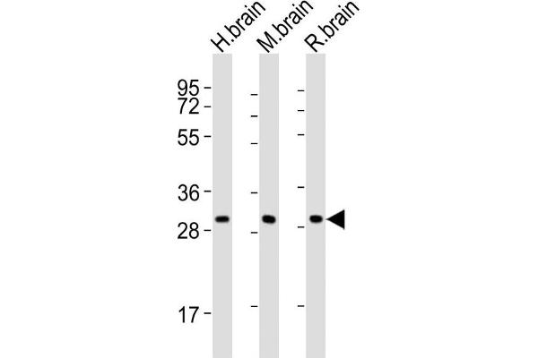 KCNMB2 Antikörper  (C-Term)